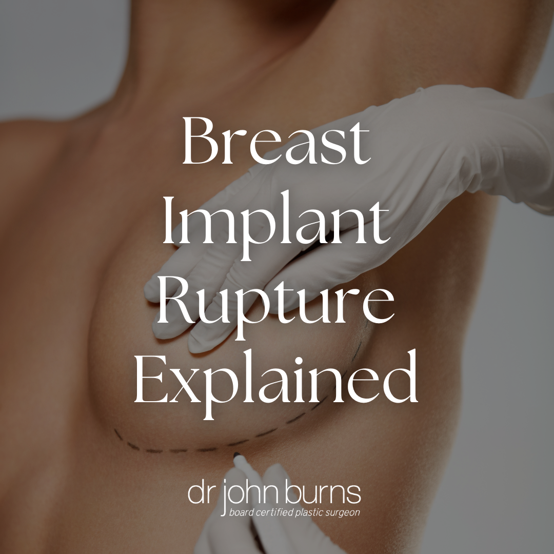 Breast Implant Rupture Explained