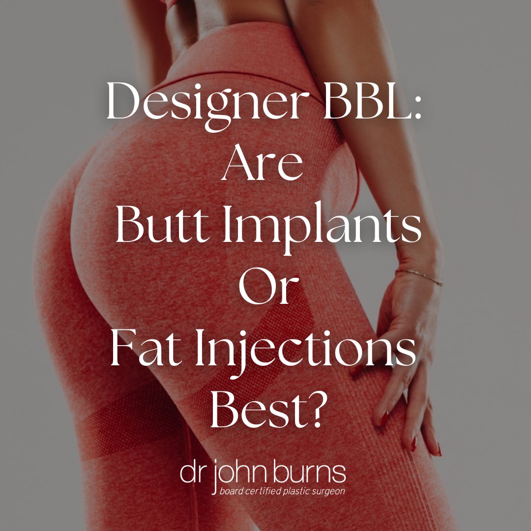 Designer BBL: Are Butt Implants or Fat Injections Best?