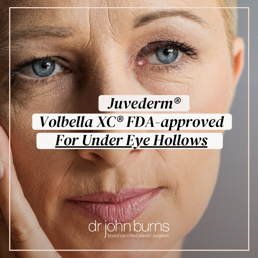 FDA Approves JUVÉDERM® VOLBELLA® XC For Undereye Hollows