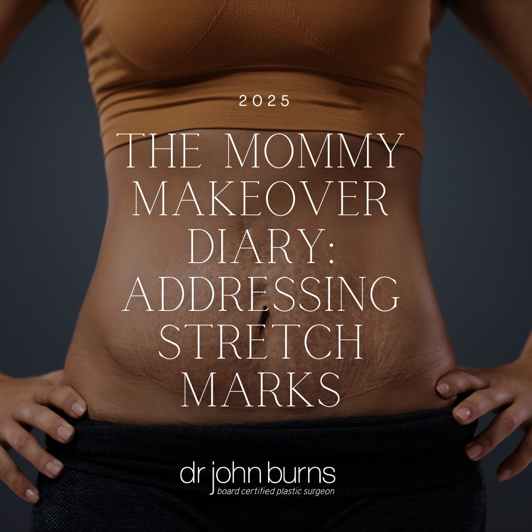 The Mommy Makeover Diary: Addressing Stretch Marks