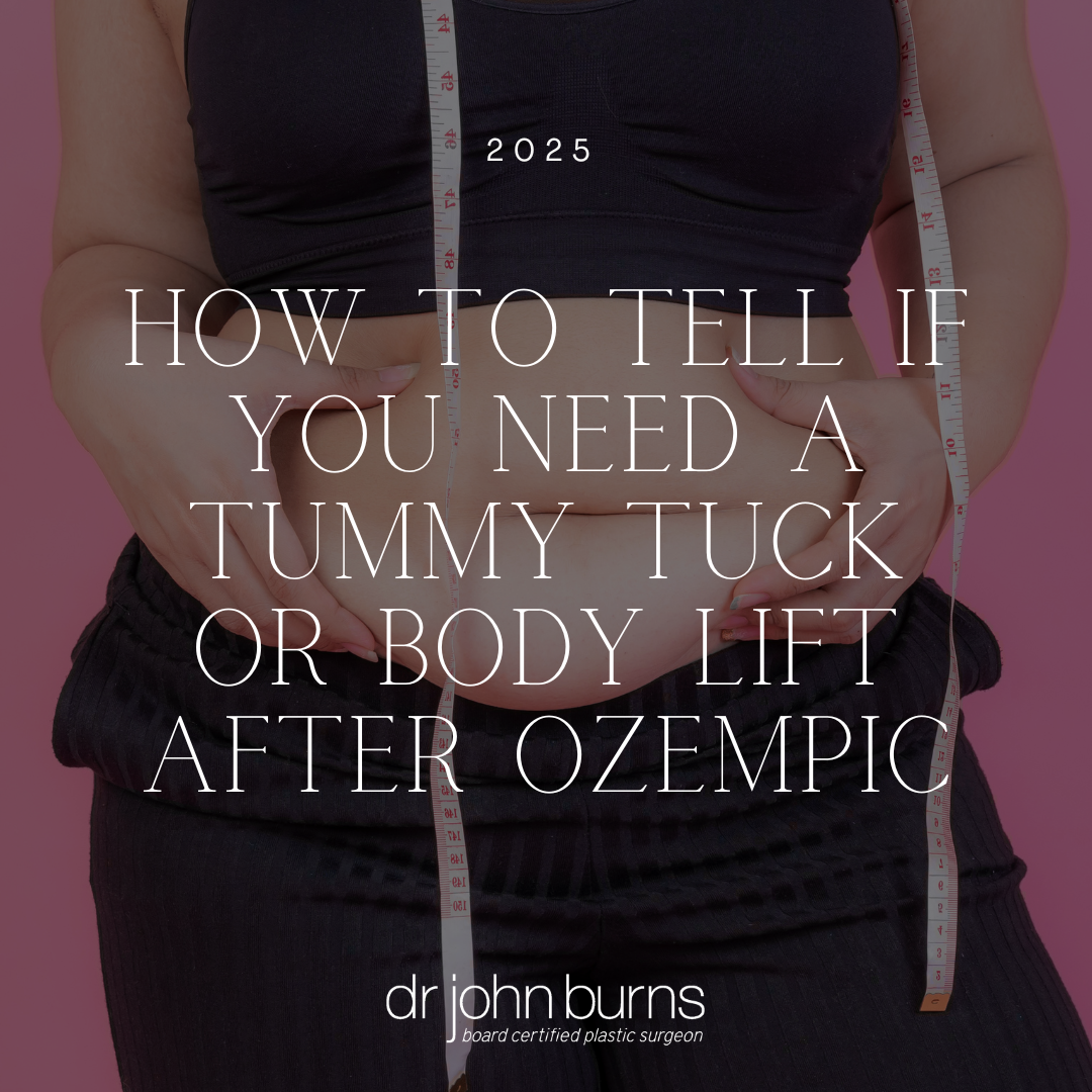 How to Tell If You Need a Tummy Tuck or Body Lift After Ozempic