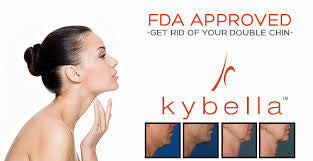 Advanced Kybella Treatment Techniques