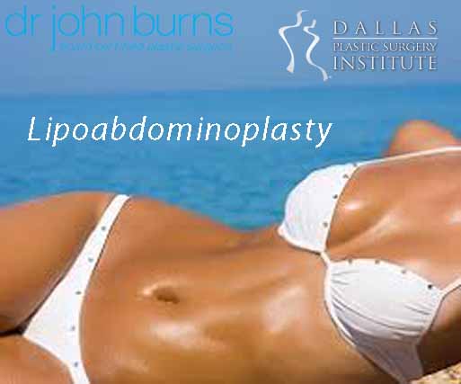 Lipoabdominoplasty:  Advanced Body Contouring